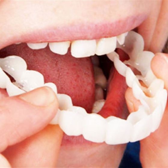 Flexible snap-on cosmetic tooth covers - product photo 5