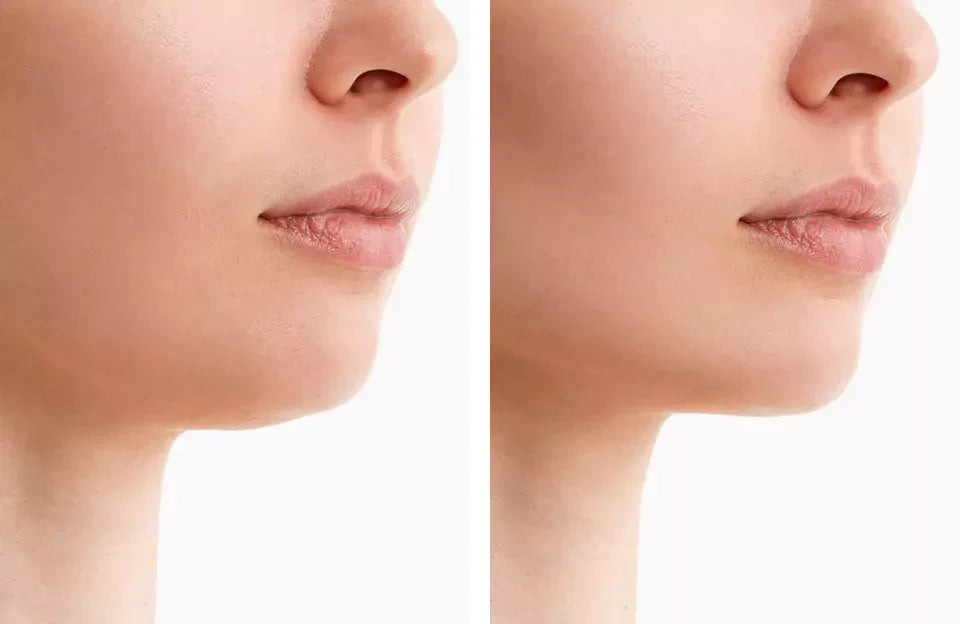 LED red light chin and jaw wrap - product photo 5