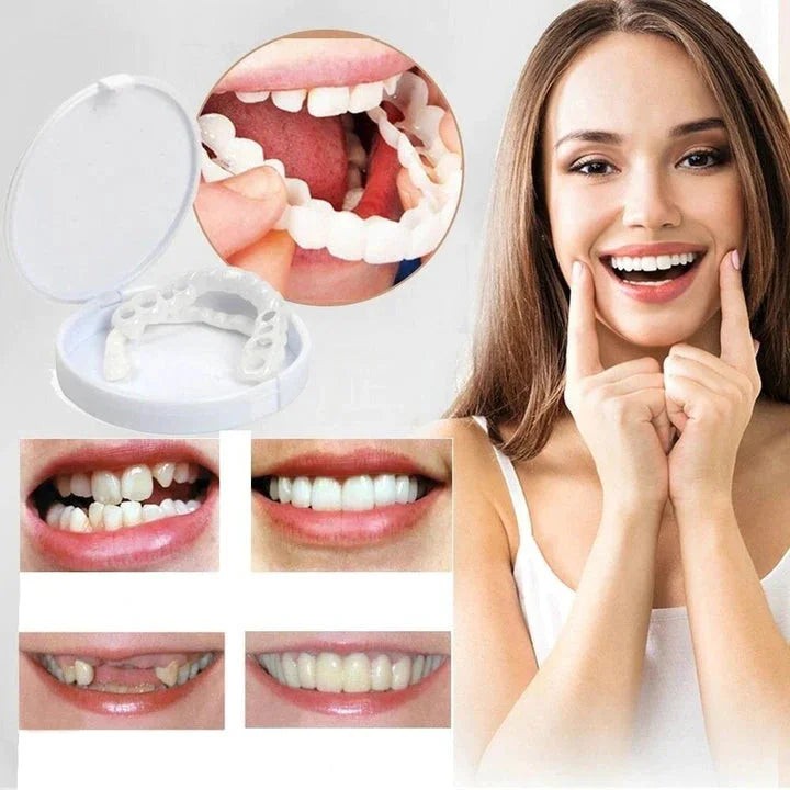 Clip-over cosmetic tooth cover - product photo 2