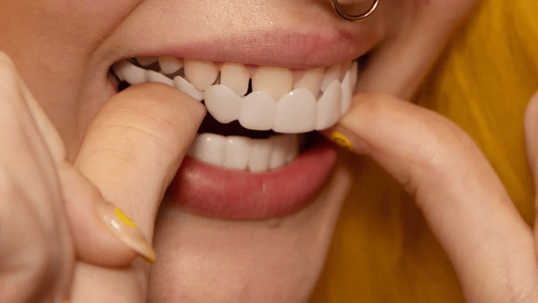 Clip-over cosmetic tooth cover - product photo 7